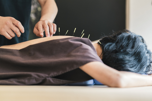 The Purpose Of Acupuncture Treatment